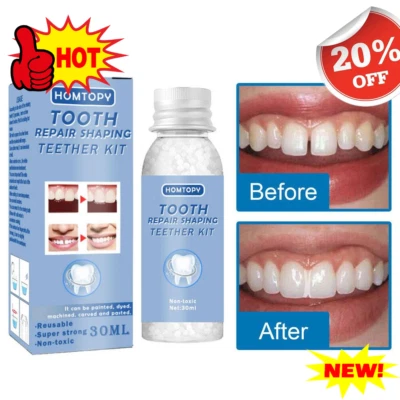 Permanent Teeth Tooth Repair-Strong Dental Cement Cavity Filling Kit Fake Teeth☾