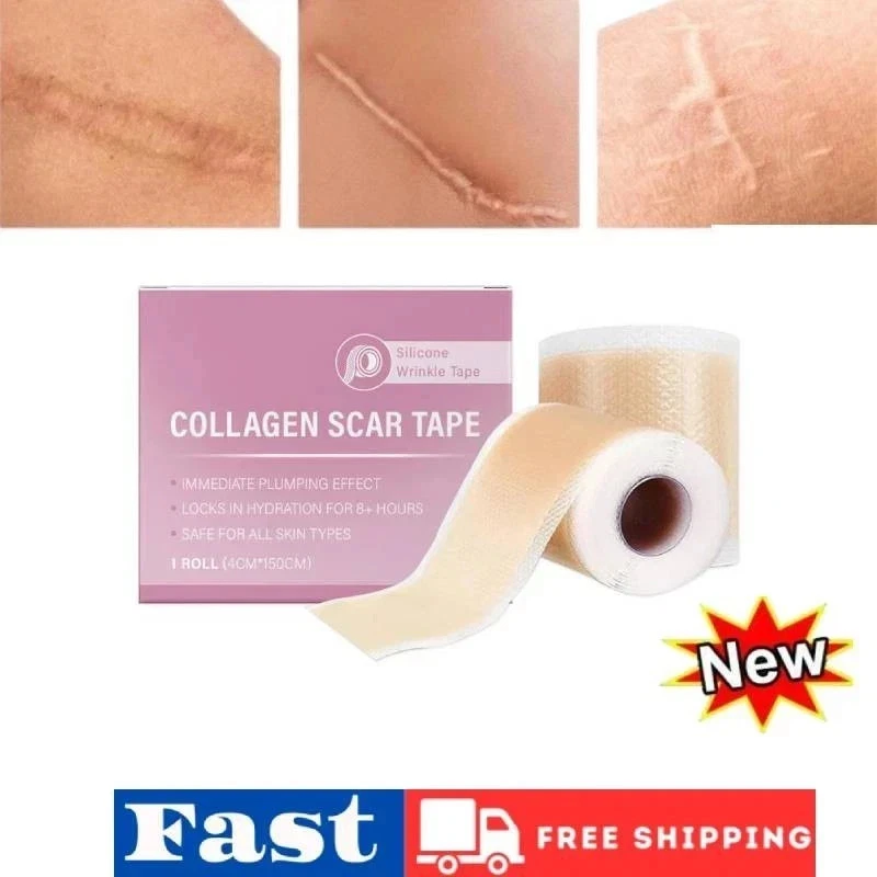Collagen Scar Tape For Face, Losveo Silicone Scar Sheets For Face Wrinkles L3A - Image 1 of 4