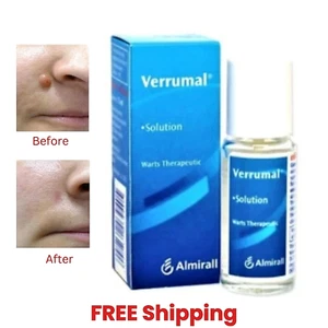 VERRUMAL Lösung zur effektiven Entfernung von Warzen & Hühneraugen Therapeutisch 13 ml - Bild 1 von 5