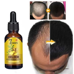 Suero de crecimiento del cabello de jengibre para fortalecer el cabello fino 10/20/40ML - Imagen 1 de 11