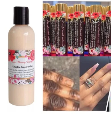 x1 KNUCKLE ERASER LOTION COMBO + x1 KNUCKLE OIL,7DAYS RESULTS CLEAN,CLEAR RESULT - Image 1 of 4