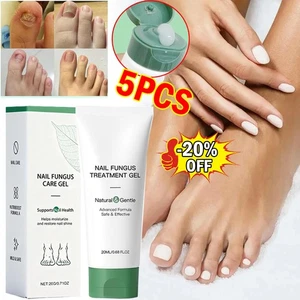 Nutraboost Nail Fungus Treatment Gel, Nail Fungus, Fungus Cream (1-5PCS) - Picture 1 of 23