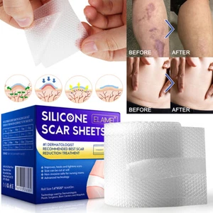 Silicone Scar Sheets Adhesive Silicone Scar Tape Roll Professional Scar gupZE - Picture 1 of 12