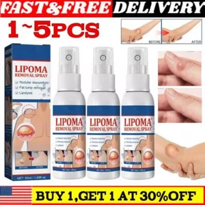 1-5X Spray Reductor Lipomheilung, Spray Eliminador Instantáneo de Lipomas Sin Grumos NUEVO - Imagen 1 de 12