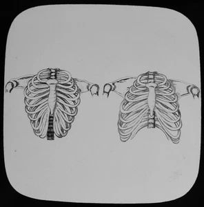 Magic Lantern Slide HUMAN PHYSIOLOGY NO11 LACING C1888 MEDICAL ILLUSTRATION - Picture 1 of 2