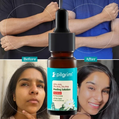 Suero facial y corporal Pilgrim para eliminar el bronceado y piel brillante para hombres y mujeres 10 ml Foto 1 de 4