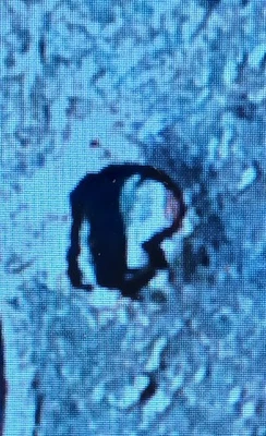 1981 P Washington Quarter Rpm-P Over D Variety - Image 1 of 4