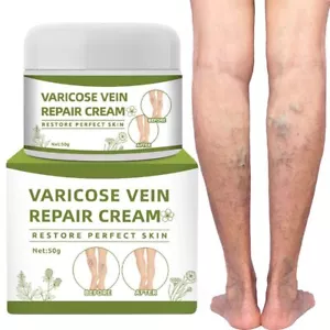 Varicose Veins Cream Spider Veins Repair Cream Varicose & Spider Veins Leg Cr... - Picture 1 of 7