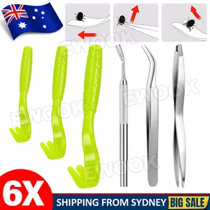 6-Pet Tick Remover Tool Stainless Steel Fleas Lice Tweezers Clip Set for Cat AU - Picture 1 of 10