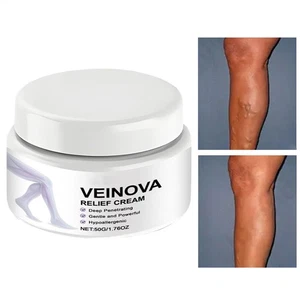 Crema para venas varicosas para piernas, crema suave calmante para piel para piernas, hidratante - Imagen 1 de 10