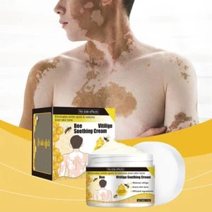 30g Bee Vitiligo Care Cream,Bee Vitiligo Care Cream For All Types Skin I5R1 - Picture 1 of 15