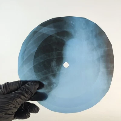 PINK FLOYD APPLES & ORANGES X-Ray USSR Record Roentgen Bone Ribs Music Vinyl - image 1 of 2