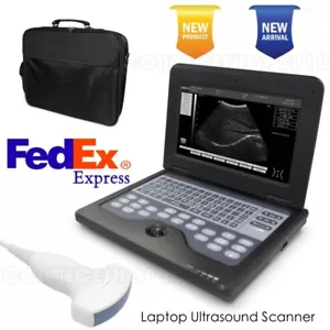 Portable Laptop Machine Digital Ultrasound Scanner Probes Multiple selections US - Picture 1 of 26