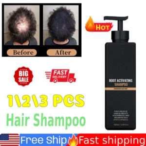 1/2/3X Root Activator Shampoo, Haarausfall Shampoo Aktivator Haar Unisex Shampoo - Bild 1 von 19