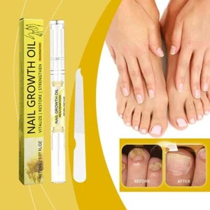 Nail Oil Cuticle Pen Effectively Moisturize The Skin Around The Nails^ M7H2 - Picture 1 of 18