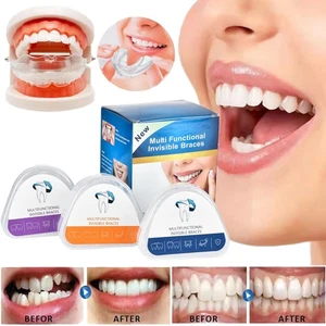 3Stage Dental Orthodontic Teeth Corrector Braces Tooth Retainer Straighten Tool - Picture 1 of 18