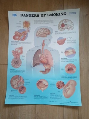 Dangers Of Smoking Pfizer Poster - Image 1 of 4