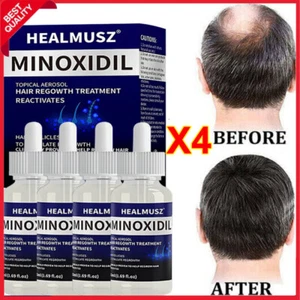 Minoxidil 5% Extra Strength Men Hair Regrowth Solution Treatment 4 Month Supply - Picture 1 of 18