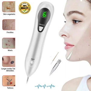 Electric Laser Plasma Pen Mole Removal Dark Spot Remover Skin Wart Tag Tattoo - Picture 1 of 10