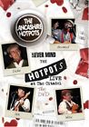 Lancashire Hotpots - The Lancashire Hotpots: Never Mind The Hotpo... - DVD  PGVG
