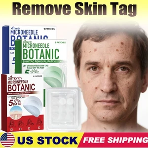 MICRONEEDLE BOTANIC Skin Tag & Acne Patch Skin Tag Remover Patches 9Pcs HOT 2025 - Picture 1 of 27