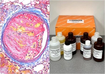 Kit de manchas VitroView™ Martius azul escarlata (MSB) (Cat# VB-3036) Foto 1 de 4