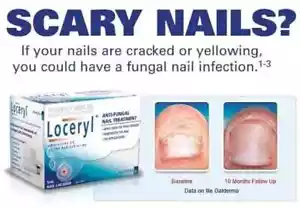 (Lo último) # Esmalte hongos para uñas 2,5 ml ENVÍO GRATUITO Y RÁPIDO - Imagen 1 de 7