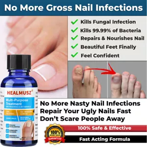 ANTI-FUNGAL MAXIMUM STRENGTH TOENAIL FUNGUS ATHLETES FOOT FUNGI NAIL SUPPORT - Picture 1 of 18