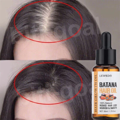 Suero de aceite de batana para un crecimiento saludable del cabello anti-pérdida de cabello reparación de raíces de cabello dañado Foto 1 de 4