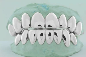 SÓLIDO 10K 14K 18K BLANCO REAL Oro Corte Perm Diseño Calce Personalizado Parrilla Grillz - Imagen 1 de 5