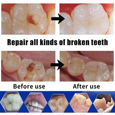 False Teeth Temporary cosmetic missing tooth filler Fake Teeth Glue Tooth Gaps