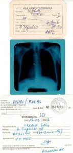 Rumänien, 2002, Vintage medizinische Röntgen-/Röntgenakte - Bild 1 von 2