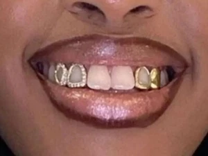 Custom Fit 14K Gold Plated Mouth Teeth Double Open Face Iced Grillz Cap 2Pc Set - Picture 1 of 4