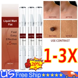 Common and Plantar Moles-Off Wartsoff Remover, WipeOff Tags&Moles Remover USA - Bild 1 von 19