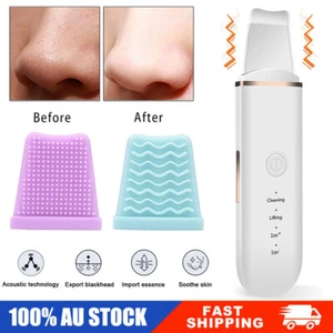 Facial Skin Scrubber Face Clean Care Ultrasonic Dirt Cleaning Blackhead Remover - Picture 1 of 18