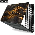 Marble Painted Skin Rubberized Macbook Hard Case Cover For New Macbook Pro Air