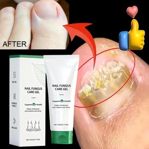 Nutraboost Nail Fungus Treatment Gel, Nail Fungus, Fungus Cream USA - Picture 1 of 18
