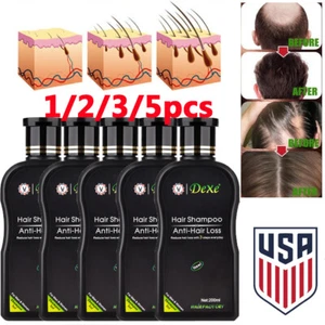 5/3x Dexe Original Anti Hair Loss Shampoo Natural Herbal Hair Growth Treatment - Picture 1 of 19