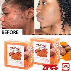 2× Tumeric Soap Skin Whitening Dark Spots lightening Acne Brightening Turmeric - Picture 1 of 17