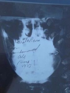 Muhammad Ali Broken Jaw X-ray March 31, 1973 Muhammad Ali Ken Norton Fight  XRAY - Picture 1 of 13