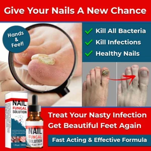 NEW ANTI FUNGAL NAIL REPAIR LIQUID INFECTION ANTIBACTERIAL TREATMENT TOE FINGER - Picture 1 of 5