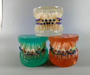 Dental Orthodontics Practice Model With Metal Brackets Buccal Tubes Ligature Tie - Picture 1 of 12