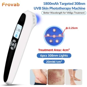 308nm UV Excimer Phototherapy Lamp Light Therapy for Eczema Repigmentation Home - Picture 1 of 23