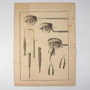 ANTICA STAMPA INCISIONE FRANCESE DI MEDICINA CHIRURGIA OTTICA OCCHI OCULISTICA - Photo 1/5