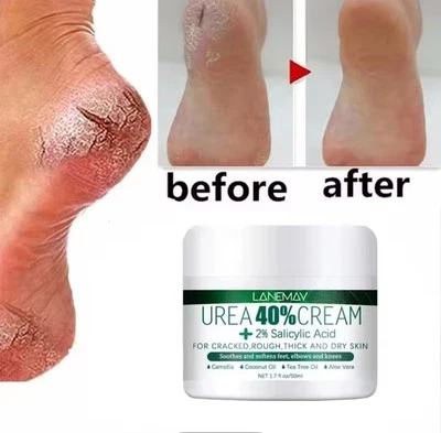 STAY VM Herbal Anti Foot Cream For Heel Cracking Repair