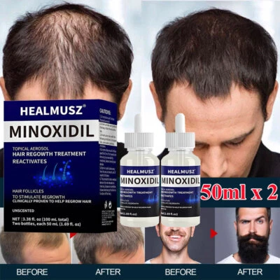 Minoxidil 5% Extra Fuerza para Hombres - Tratamiento de Regeneración del Cabello, Crecimiento de Cabello Más Grueso Foto 1 de 4