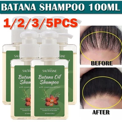 Aceite de Batana y Romero Champú Natural Crecimiento del Cabello Anti Pérdida Daño Cuero Cabelludo Grueso Foto 1 de 4