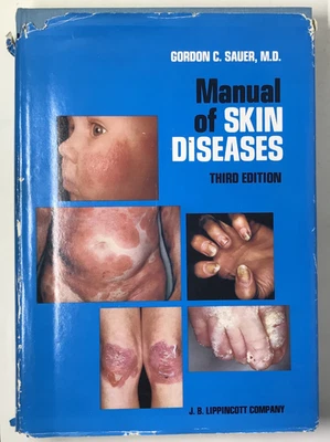 Manual of Skin Diseases - Third Edition - Gordon Sauer - 1973 - Illustrated Foto 1 de 4