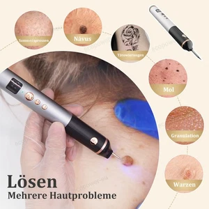 15-levels LCD Muttermal Entfernen Stift Plasma Pen Warzen Entfernen Mole Removal - Picture 1 of 10