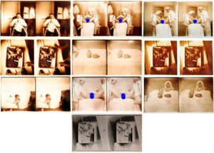 photographies 13 STÉRÉOS MÉDICALES  GYNÉCOLOGIE vers 1900 - 1920 - Imagen 1 de 24